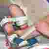 A nurse adjusting a young boy's splints